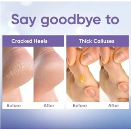 2 pares de mascarilla exfoliante exfoliante para pies pies suaves para eliminar callosidades de piel muerta