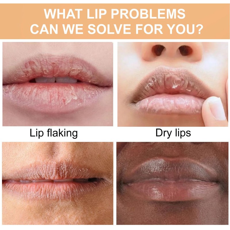 Turmeric Lip Balm for Smokers With Root Oil - Brightening
