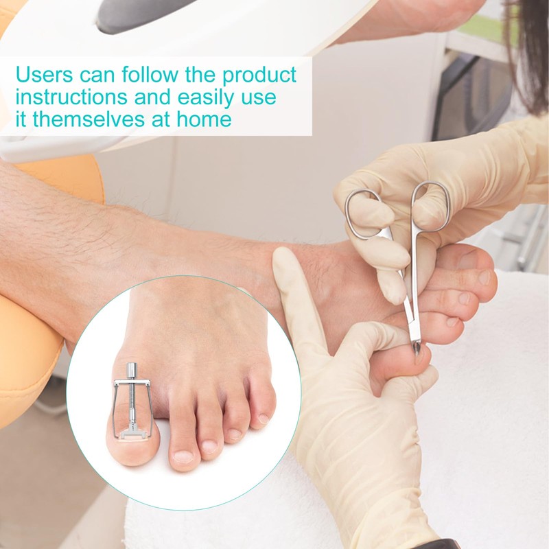 Ingrown Toenails Set Toenail Correction Patch Corrector Pedicure Stainless Steel
