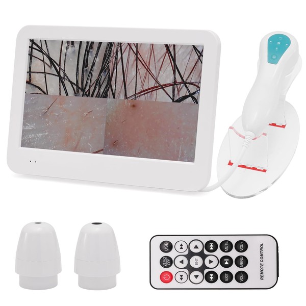 Beauty Star Scalp Analysis Machine, 12 inches Skin Tester Diagnosis