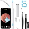 FOLAI Ear Wax Removal Kit,HD Ear Scope Ear with Camera,WiFi