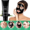 Limpieza Facial Elimina Puntos Negros Carbón Activado Full