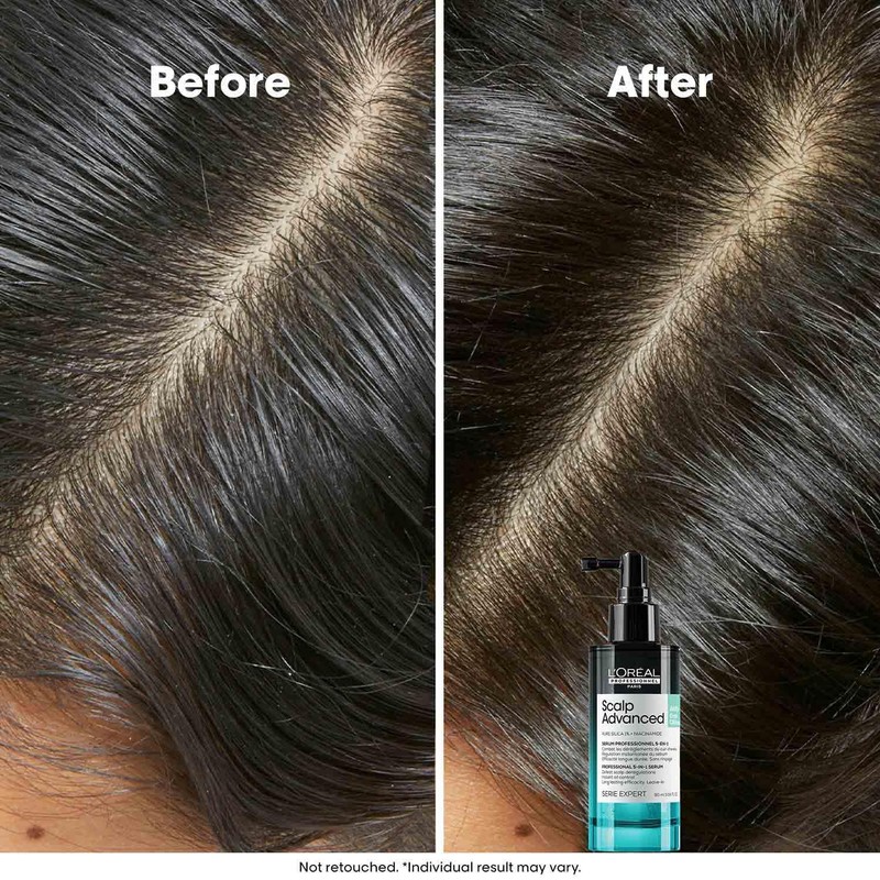 L'Oreal Professional Scalp Serum Scalp Superior 90ml