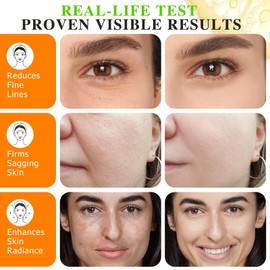 Vitamin C Serum Gesicht 20% Hyaluronic Acid Serum Niacinamide Korean Skincare Hyaluron Leistungsstarkes Vitamin C Gegen Dunkle Flecken Falten & Feine Linien Anti-aging 60ml