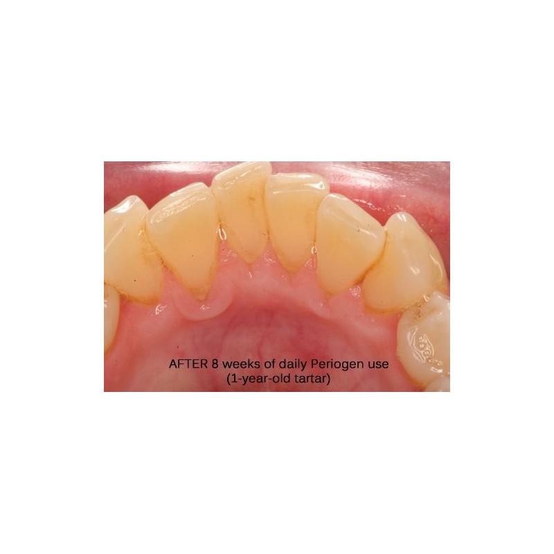 Periogen Periogen Complete Oral Health Rinse (3-PK)