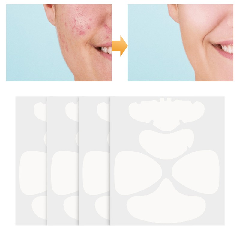Face Acne Patches Hydrating and Purifying Forehead Nose Chin Cheek