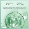 Bioaqua Crema Limpiador Acido Salicilico Antiacne Hidratante Todo Tipo De