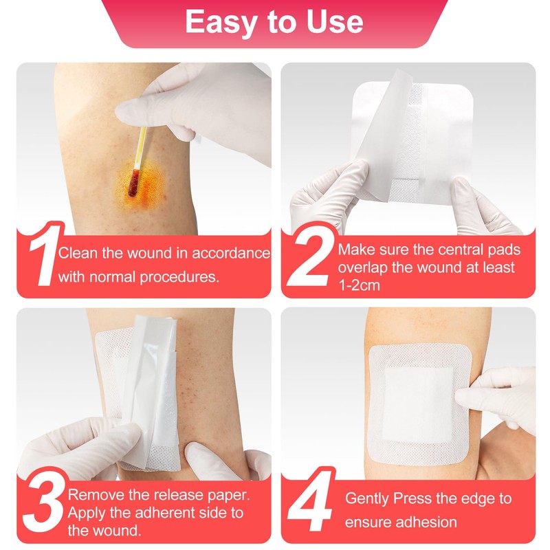 Niceful 50 Count Adhesive Gauze Island Dressing 4" x 4",