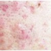뾰루지짜기 등드름압출 초등학생코피지 볼블랙헤드 턱화이트헤드 Pimple Squeezing Back Acne Extraction
