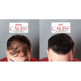 Caliss Scattered Hair, Thinning Hair for Hair Thickening, Hair Powder for Hair Loss, Hair Powder Against Light Hair and Bald Spots - 25g (Grey)