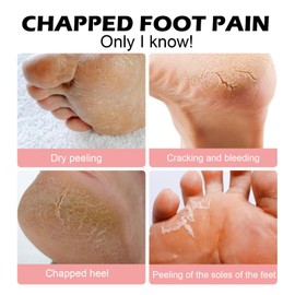 3PCS Urea Cream 60 Percent for Feet - 60% Urea Foot Creams for Cracked Heels and Dry Skin - Cracked Heel Repair Cream - Foot Moisturiser - Skin Care Cream for Hands & Feet