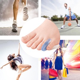 Yimanduo - Separador de dedos rosados, 10 piezas, enderezador de dedos pequeños para hombres y mujeres, caminar, correr, superposición, corrector de juanetes y alivio de juanetes