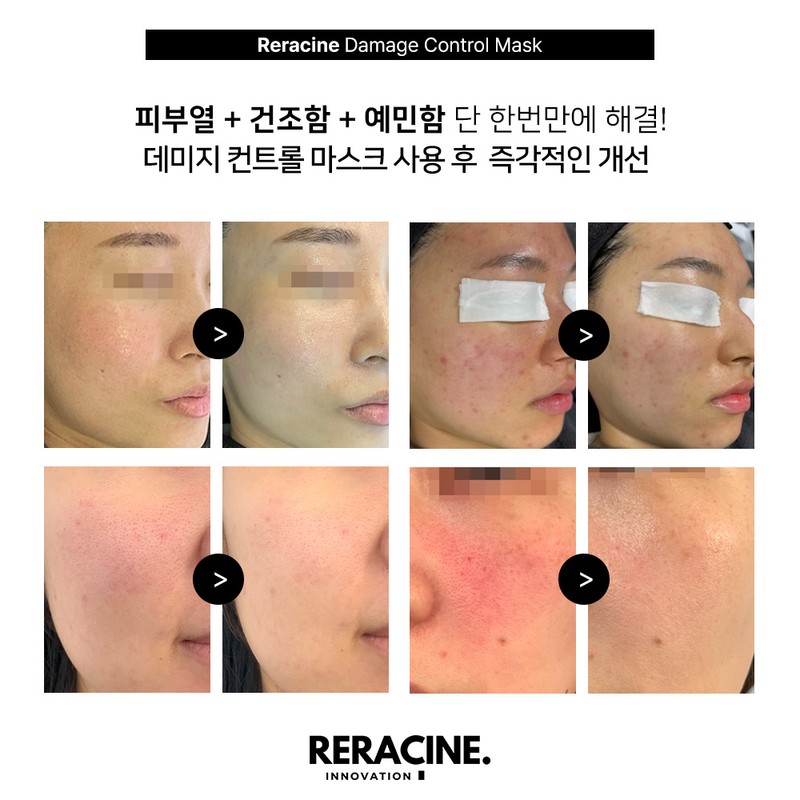 Lilacin Damage Control Sheet Mask Pack 1 box (5 sheets)