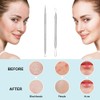 La chat Pimple Extractor Tools, Blackhead Remover, Pimple Popper, Acne