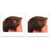 Caboki 10X Hair Powder - Trial Size:_Medium Brown