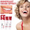UOY Toothpaste Whitening SP-4 Toothpaste, SP-4 Whitening Toothpaste Probiotic Toothpaste