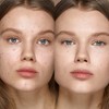 KIKO MILANO - Full Coverage Concealer for Very High Coverage