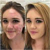 Aquapurity Phoera® Full Coverage Foundation Soft Matte Oil Control Concealer