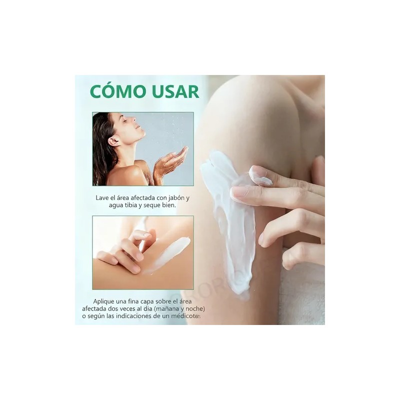 2p Crema De Psoriasis Para Varios Síntomas De Psoriasis 20g