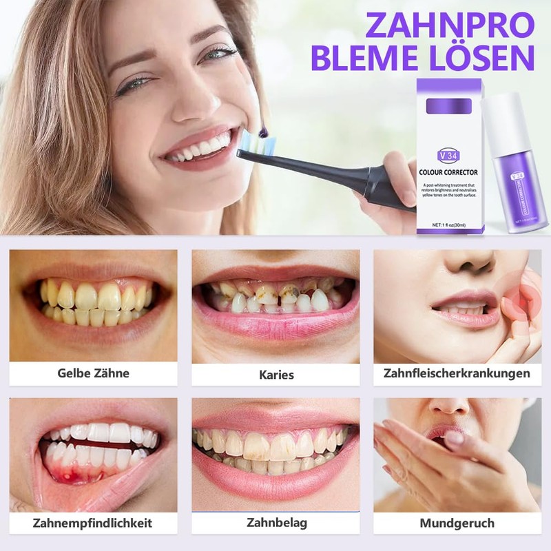 Toothpaste White Teeth, Purple Teeth Whitening Toothpaste, Gum Removal, Gum