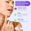ZitSticka- Parches para granos en la cara y el cuerpo,