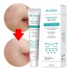 Gel Contra Barros Y Espinillas Tipo De Piel Con Acné,