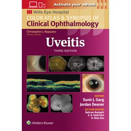 Uveitis: Wills Eye Institute Atlas Series