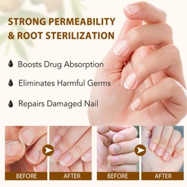 Ginger Growth Serum, Ginger Nail Treatment Oil, Nourishes The Nails Of Hands And Feet, 7 Day Repairs Damaged Nails & Cuticles, Fortifies Nails For Stronger Growth, Natural Botanical Formula 60ml