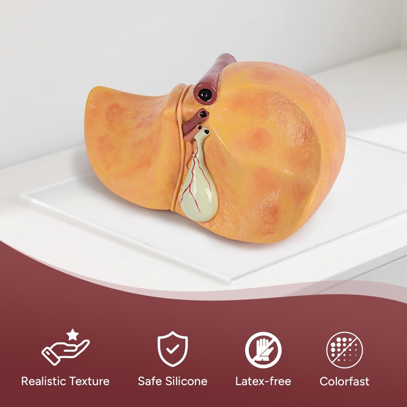 Simedutech Silicone Alcoholic Fatty Liver Model, Pathological Liver Replica for