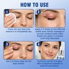 Blepharitis Treatment Serum 30ml, Natural Stye Eye Treatment with Hyaluronic