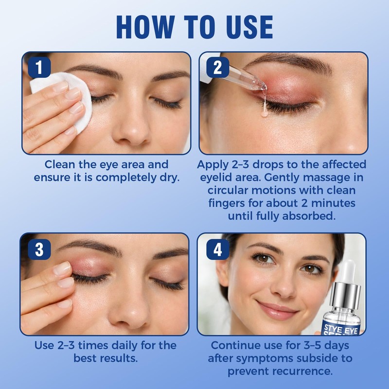 Blepharitis Treatment Serum 30ml, Natural Stye Eye Treatment with Hyaluronic