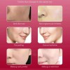 Sanendi Serum Vial Niacinamida Para Dermapen Aclarante 50ml Todo Tipo