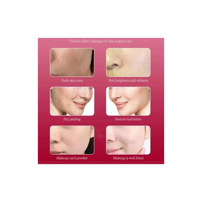 Sanendi Serum Vial Niacinamida Para Dermapen Aclarante 50ml Todo Tipo
