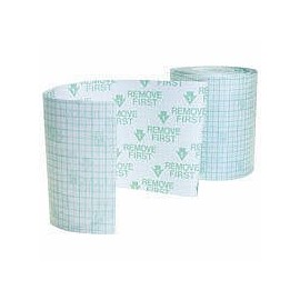 Smith WeenFashion ando・nehuxyu- Cat Management opusaitohurekisifikkusu 100 mm X 10 m 66000041 