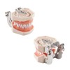 Hoite Dental Typodont Teeth Model 28 PCS Spare Teeth for