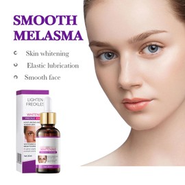 Hyperpigmentierung Behandlung Serum, dunkler Fleck Fading Serum, Alter Fleck Entfernung Serum, Sonnenfleck Radiergummi Serum, natürliche Zutaten Spot Serum Geeignet für alle Hauttypen