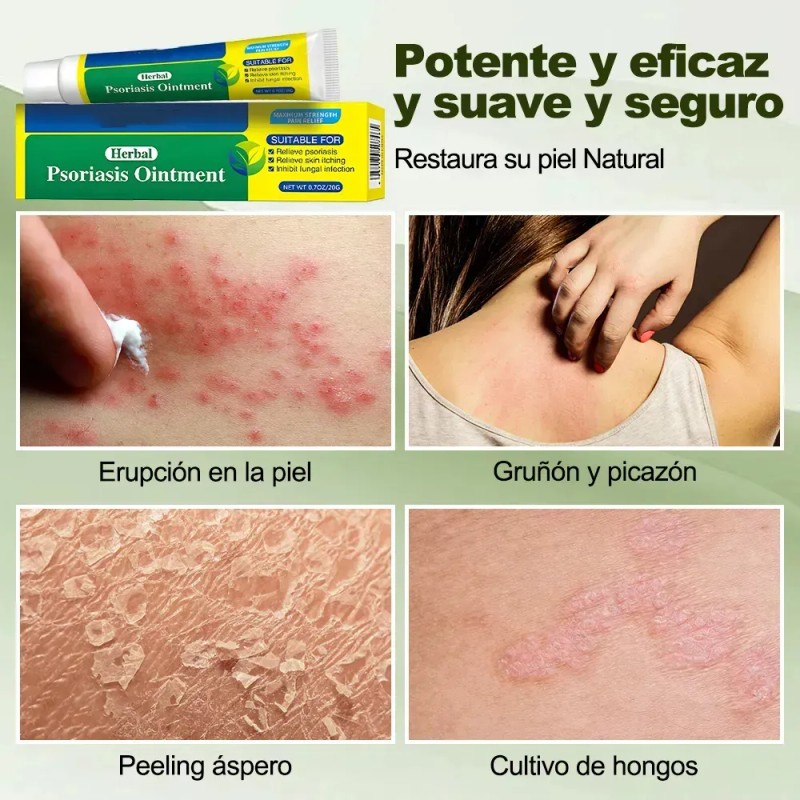 Crema De Psoriasis Para Varios Síntomas De Psoriasis 40g2pcs Neutra