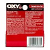 Oxy Anti Barros Espinillas Fórmula Color Piel 30g