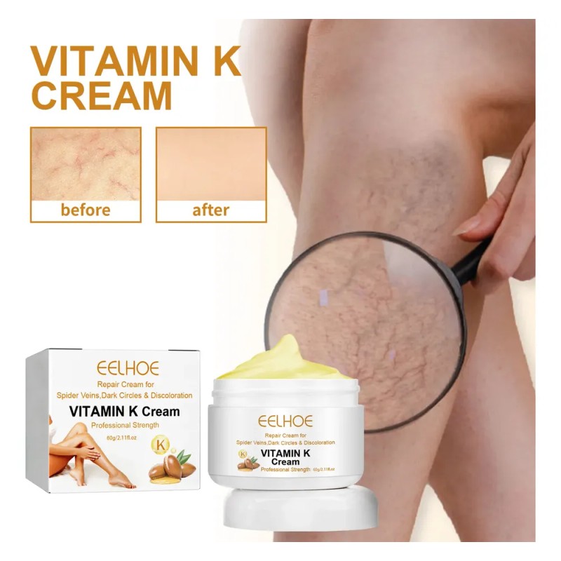 Hla Ye- Crema De Vitamina K Eelhoe Para La Hinchazón