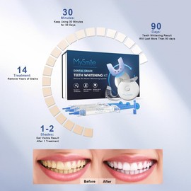 MySmile Original Teeth Whitening Kit with 5x LED Light, 18% Carbamide Peroxide Oral Care MothersDay Gift TikTok Shop Deals
