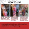 Gel Sellador Para El Cuidado Posterior Del Tatuaje: Forma Un