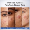 Dr. Leo loción secante para acné plus (20mL)