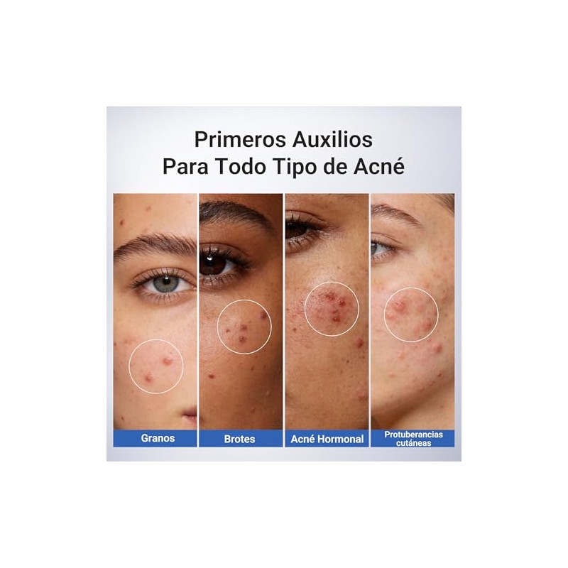 Dr. Leo loción secante para acné plus (20mL)