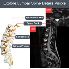 Doctor Verified Lumbar Spine Model - Life Size Human Lumbar Vertebrae Anatomy Model with Sacrum, Coccyx, Intervertebral Disc and Spine Nerves for Medical Learning & Teaching & Demonstrating