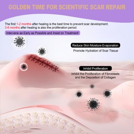 WZPB Silicone Scar Sheets for Scar Removal - Medical Grade Scar Tape for Surgical Scars, C-Section, Keloid, Hypertrophic & Acne Scars | 1.5" x 120" Reusable & Waterproof Scar Strips Roll (2 Pack)