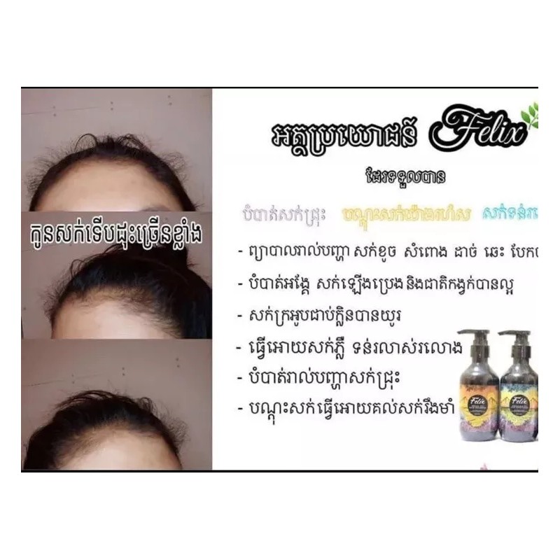 Felix 1 Set Felix Professional Hair Care ឈុតសាប៊ូកក់សក់