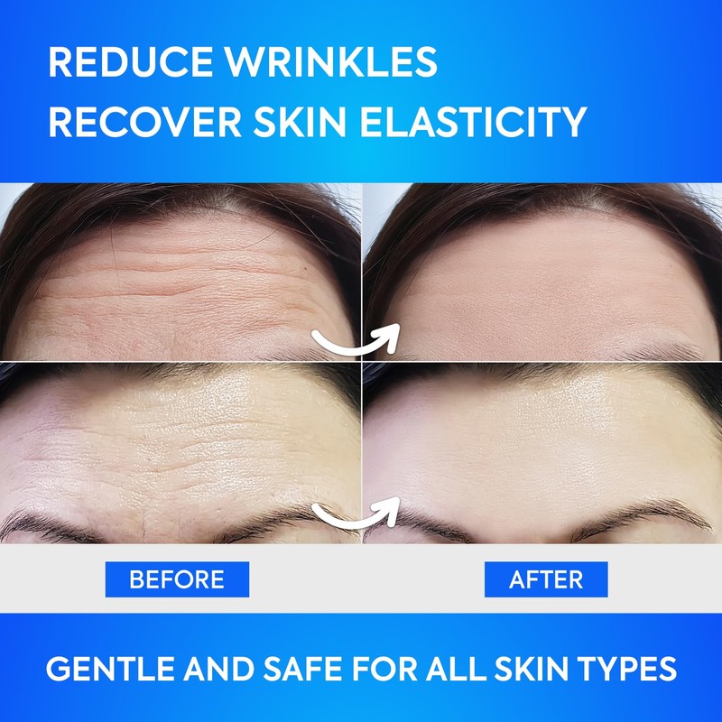 SILKDERMIS Forehead Wrinkle Patches 12Pcs with Aloe, Collagen, Vitamin E,