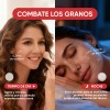 Parches Para Acné Hidrocoloide 360pcs,absorbe La Grasa