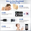 Kosimai Black Head Remover for Face Tool Professional Pimple Popper