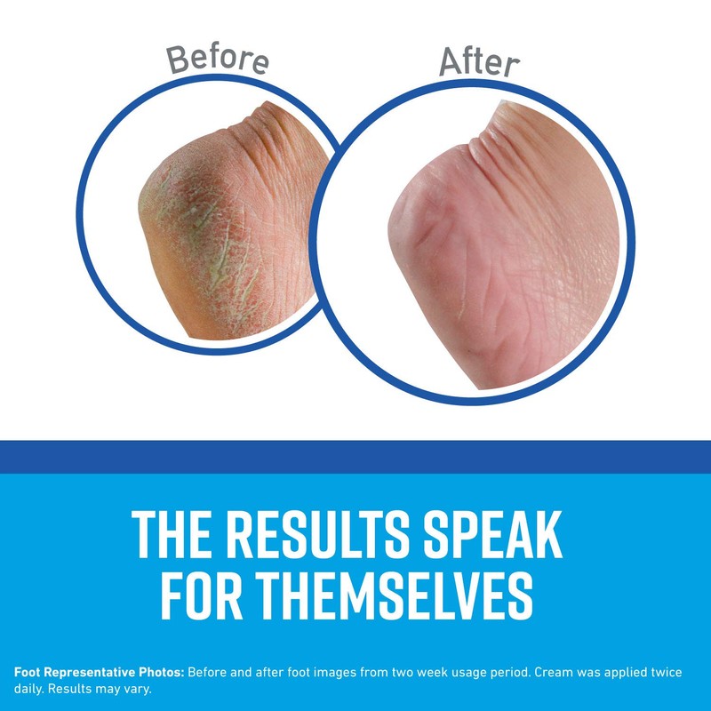 O'Keeffe's K0320001-11 Healthy Feet Foot Cream in Jar (11 Pack),